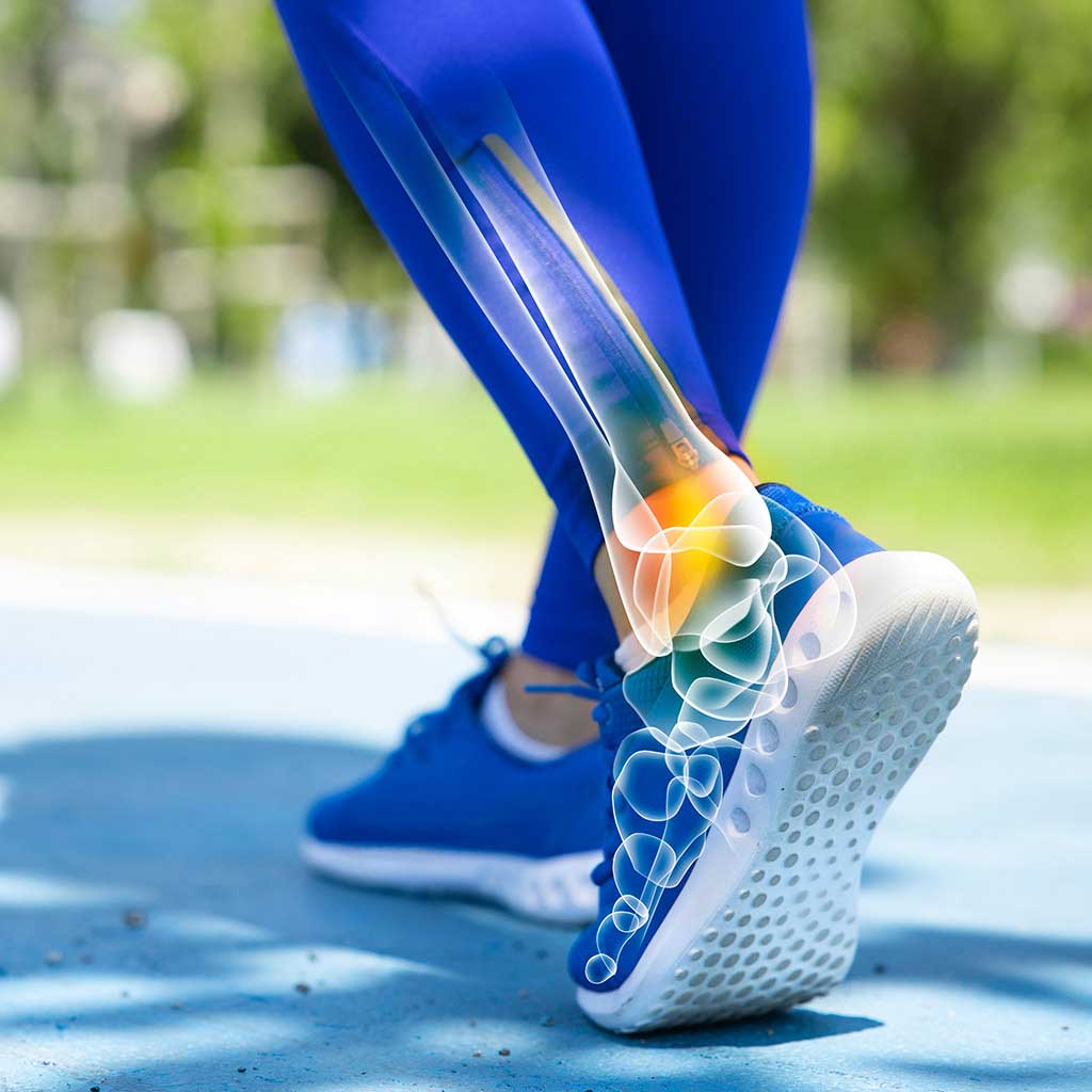 Foot & Ankle Surgery Moore, Edmond, OK OK Foot & Ankle Specialist