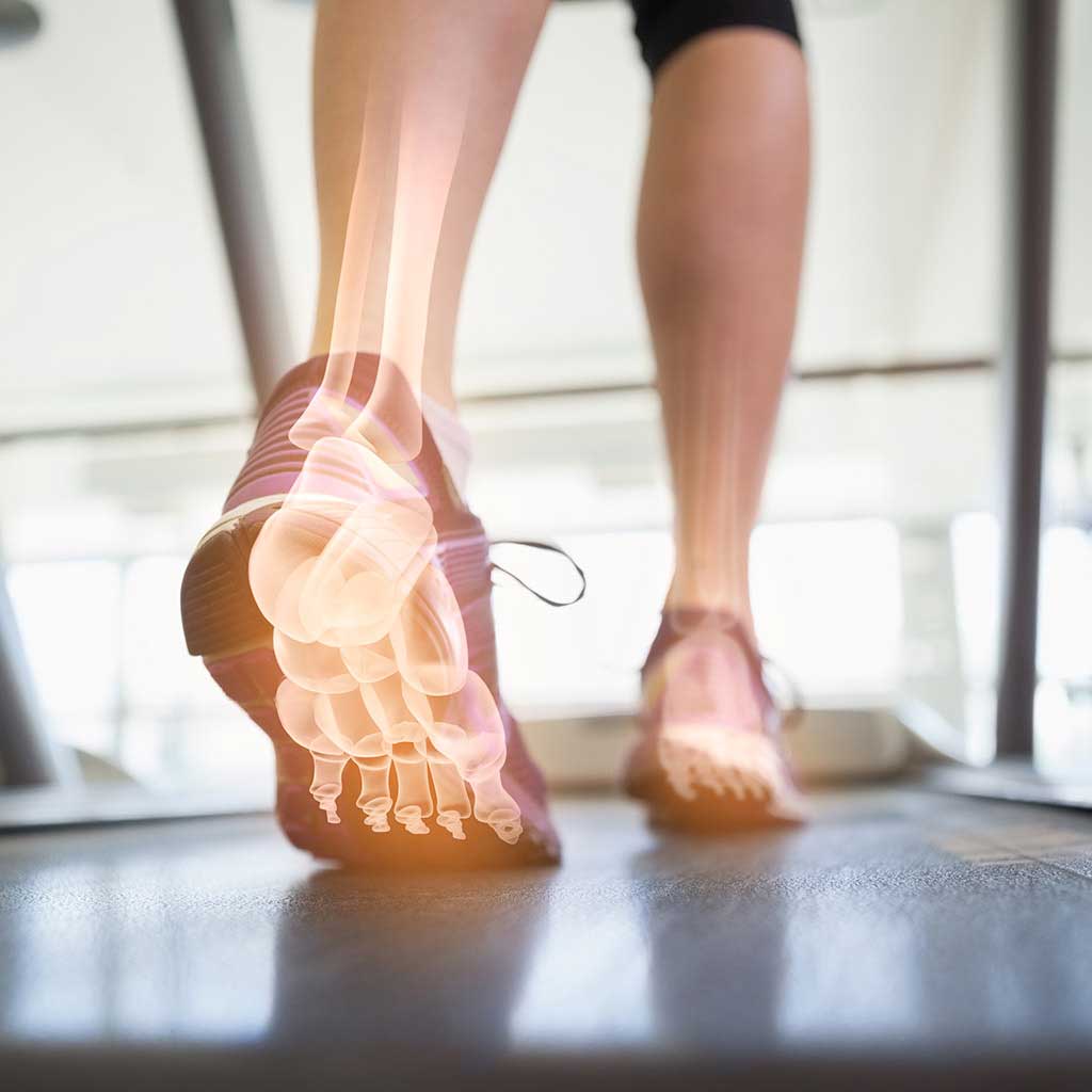 Sports Injuries Treatment Moore, Edmond OK Oklahoma Foot & Ankle