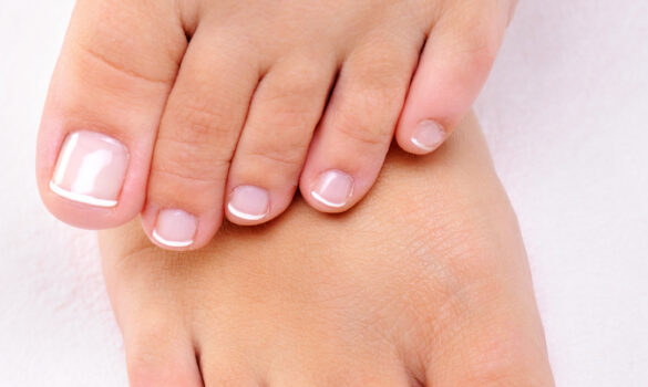 Nail Fungus Woes? Discover Nature's Solutions: Natural Remedies for Healthy Nails